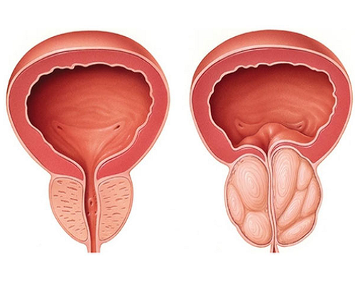The Prostate